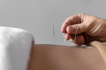 acupuncture for women